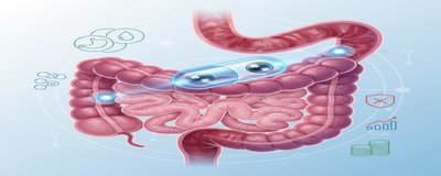 What is Capsule Endoscopy? How Capsule Endoscopy is Performed (Preparation, Risks, Results and Prices)