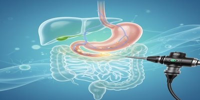 What is ERCP? How is ERCP Procedure Performed? Bile Tract Diseases and Treatment