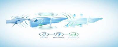 What is FibroScan? Liver Fibrosis Measurement and Advantages