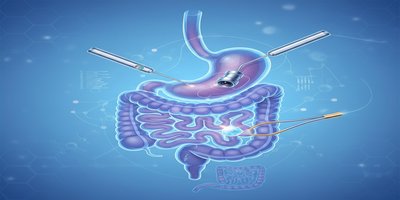 What is Gastroenterology Surgery? Which Procedures Are Performed?