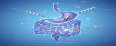 What is Gastroenterology Surgery? Which Procedures Are Performed?