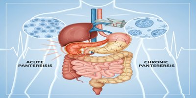 What is Pancreatitis? Symptoms of Acute and Chronic Pancreatitis (Guide to Pancreatic Inflammation)