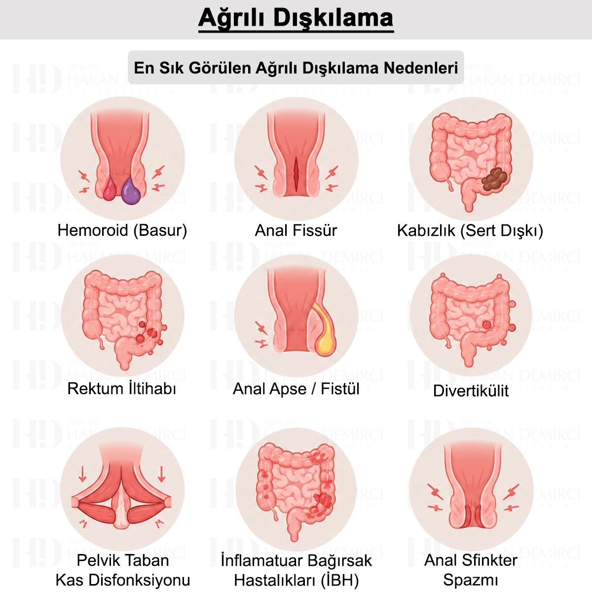 Ağrılı Dışkılama: Neden Olur? Nasıl Geçer? Tedavisi?