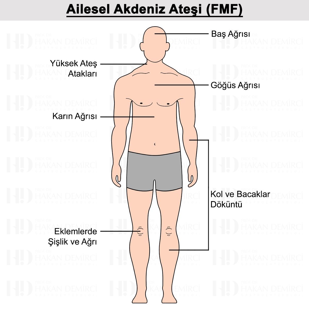 Ailevi Akdeniz Ateşi Nedir? Belirtileri, Tanısı ve Tedavisi