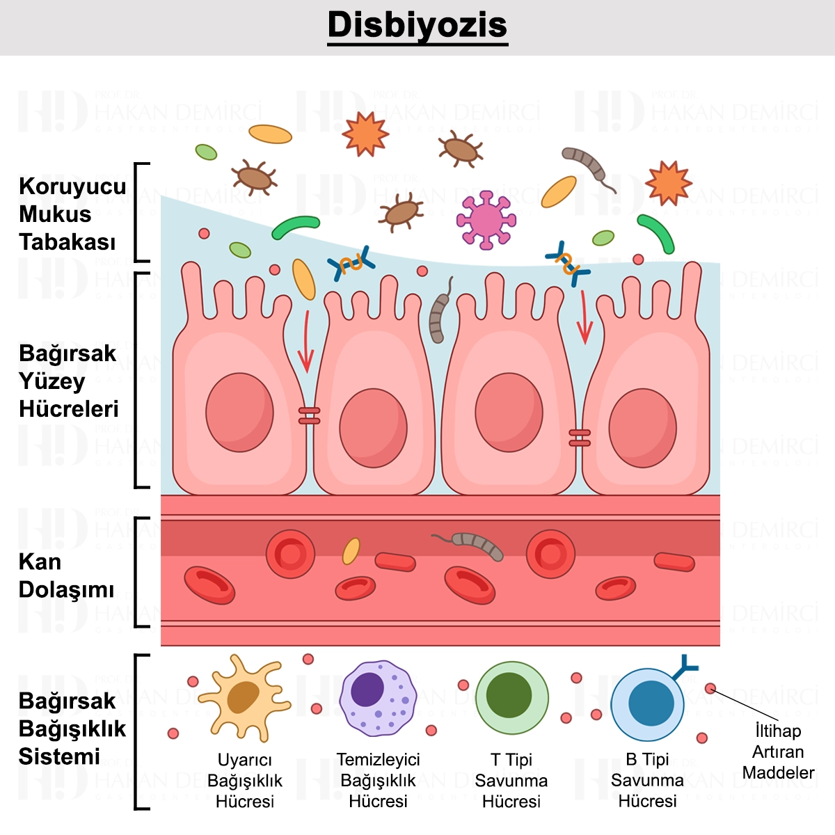 Disbiyozis Nedir? Belirtileri, Türleri ve Tedavisi