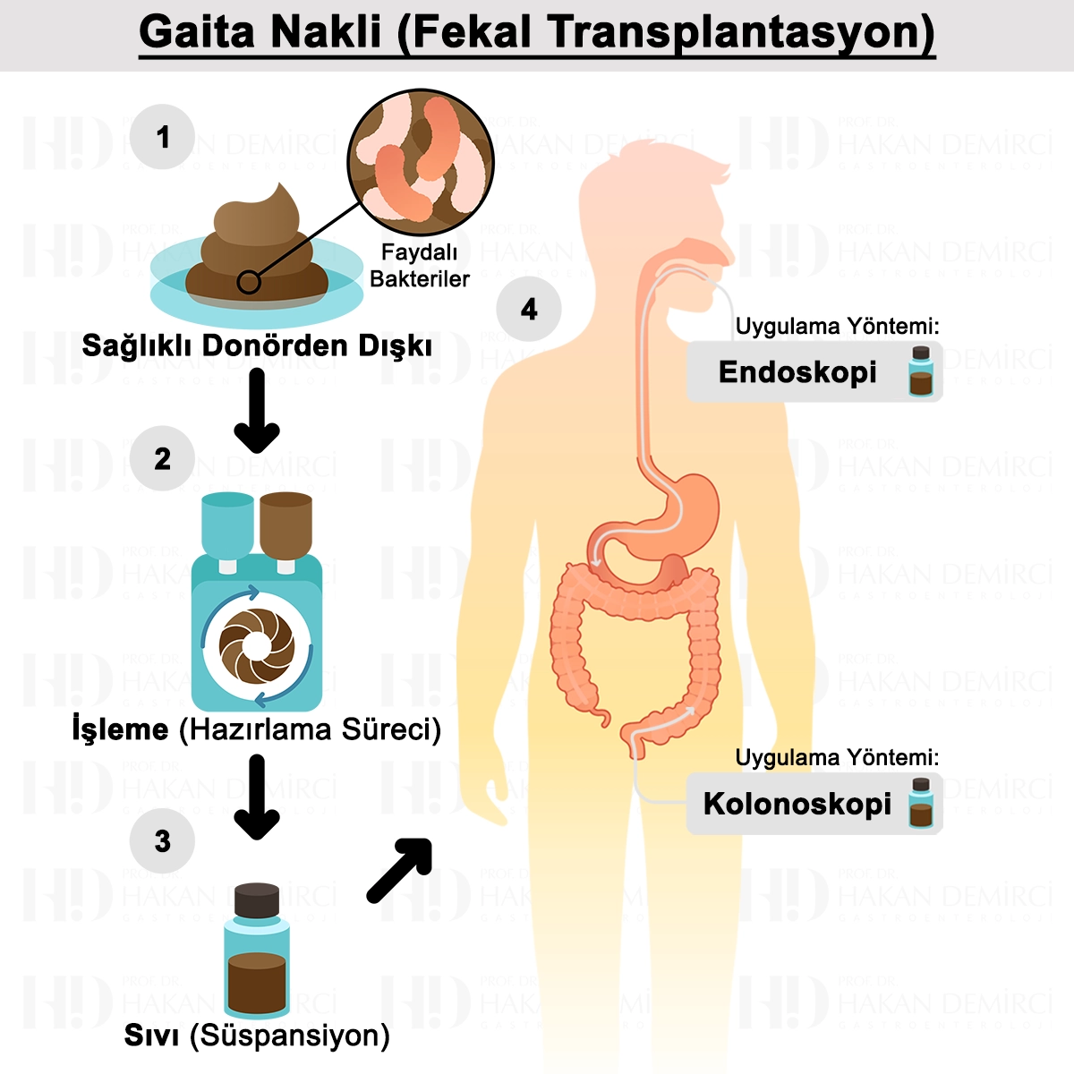 Gaita Nakli Nedir? Kullanım Alanları? Nasıl Yapılır?