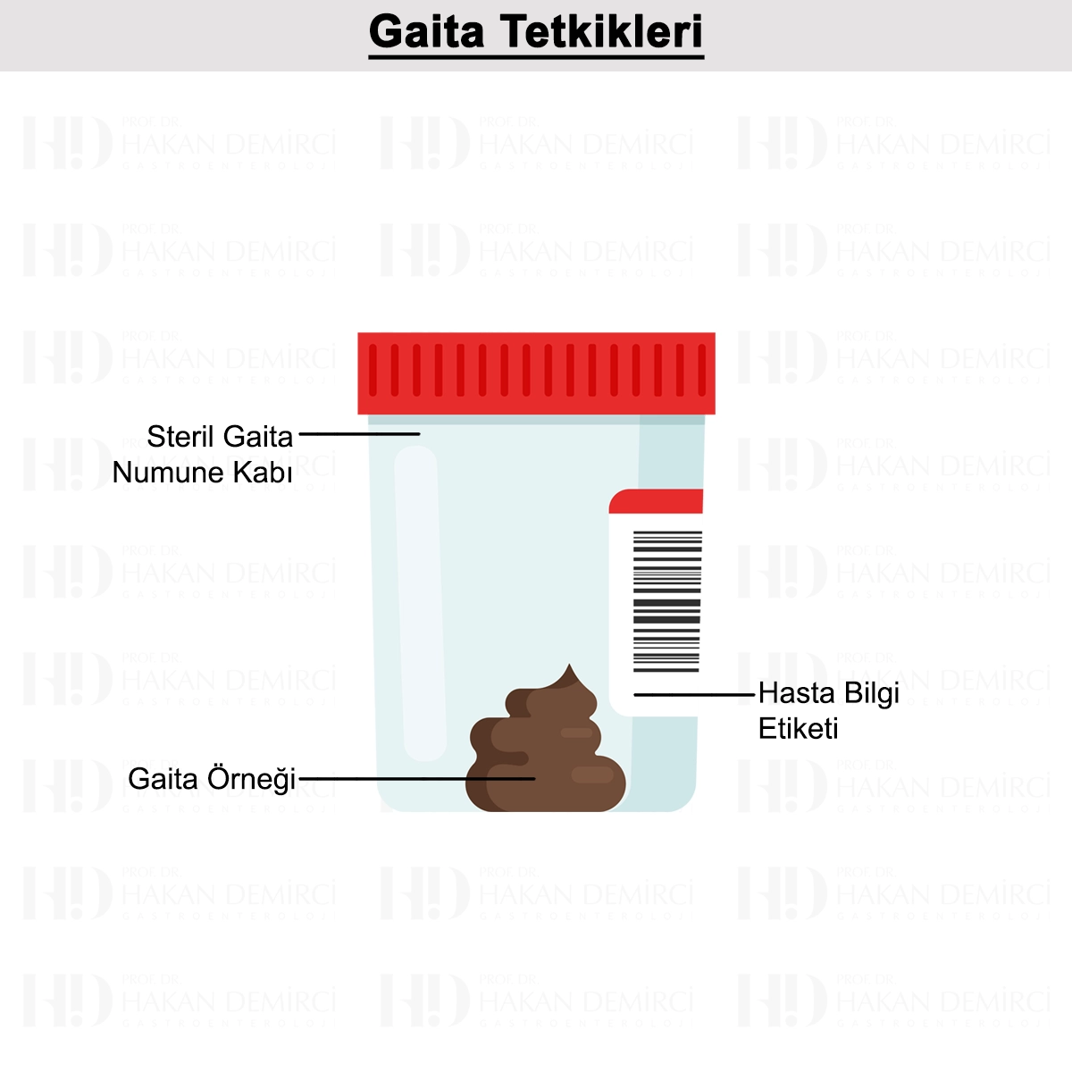 Gaita Tetkikleri: Gizli Kan, Kültür ve Kalprotektin
