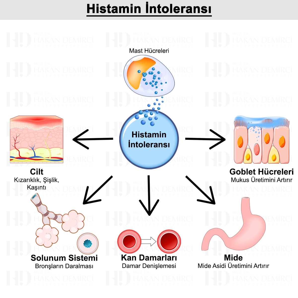 Histamin İntoleransı Nedir? Belirtileri, Tanısı ve Tedavisi