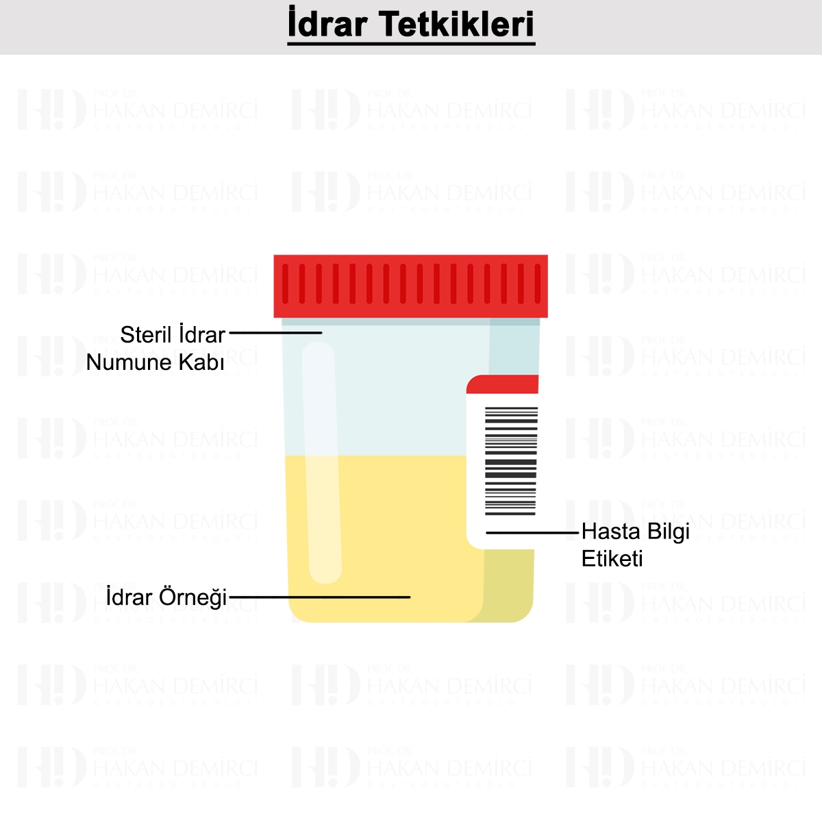 İdrar Tetkikleri: Bilirubin, Ürobilinojen ve Amilaz
