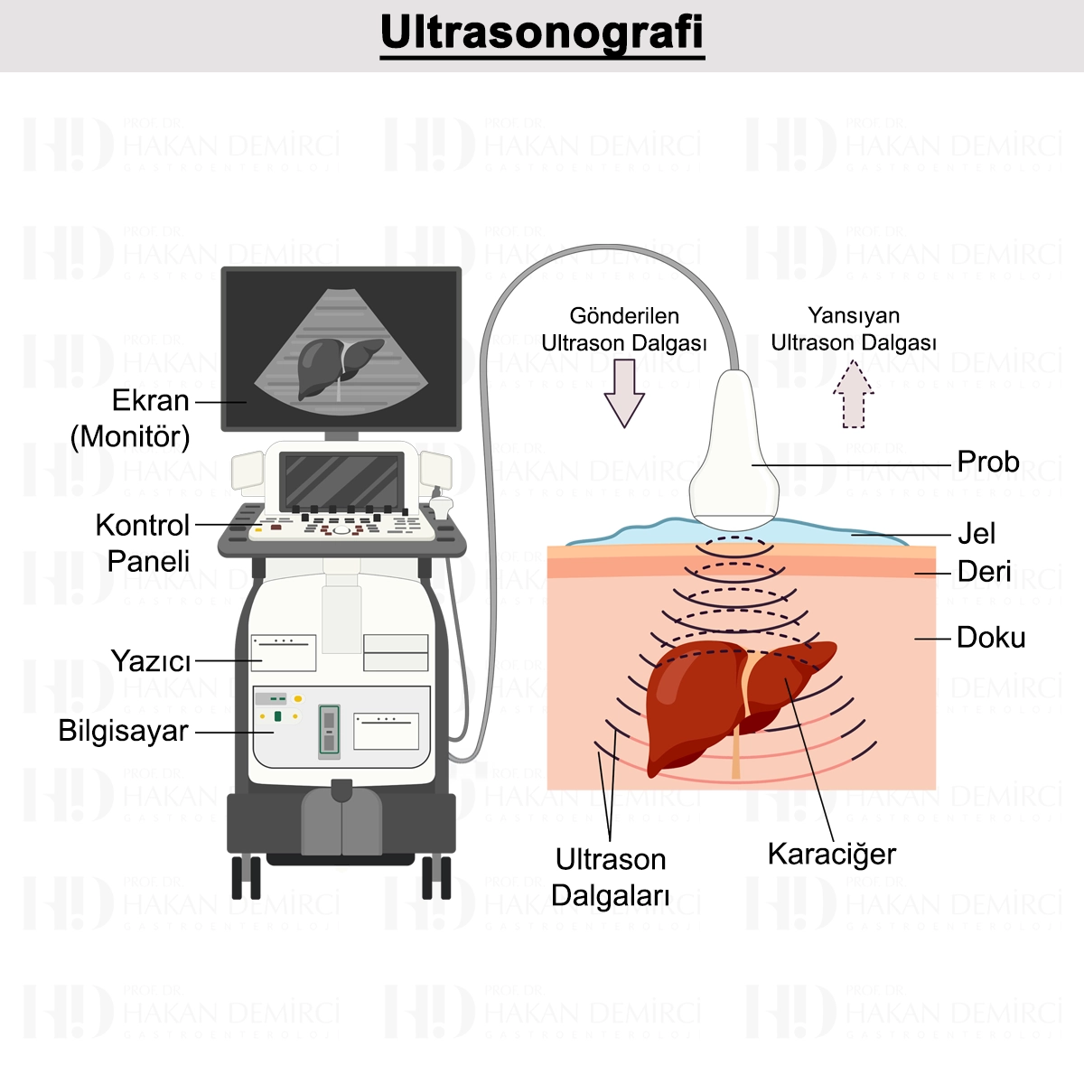 Ultrasonografi Nedir? Nasıl Yapılır? Hazırlık Süreci?