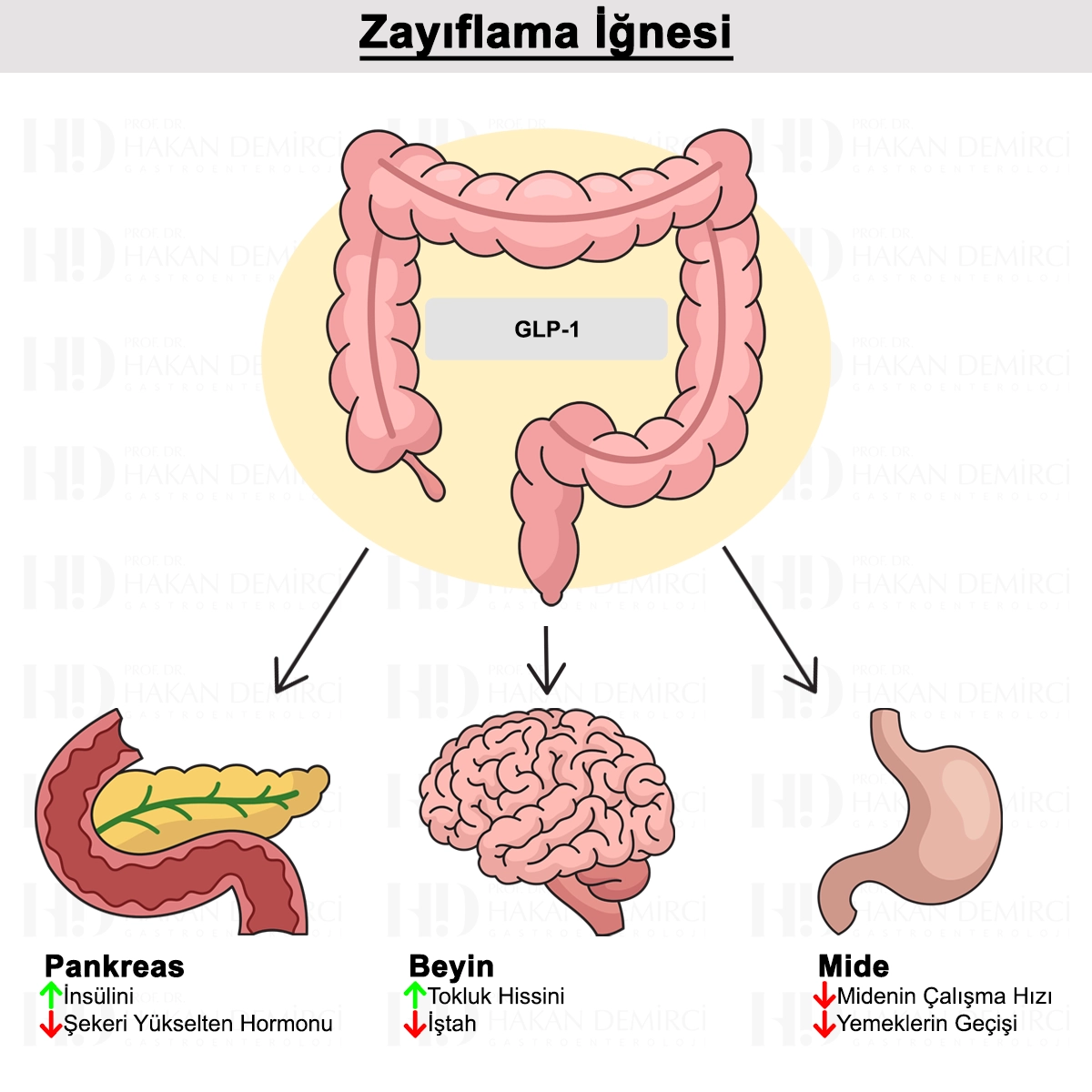 Zayıflama İğnesi Nedir? Riskleri, Tedavi Süreci ve Takibi